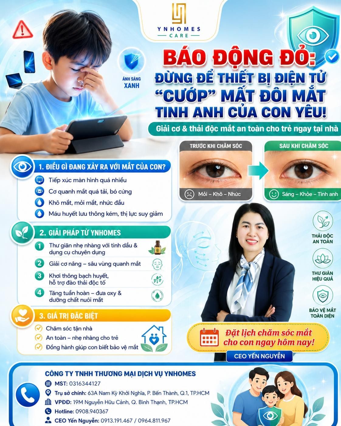 Bảo vệ mắt cho con thời đại màn hình: giải cơ và thải độc mắt an toàn tại nhà – YNHomes Care