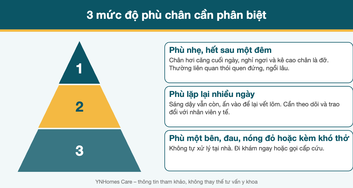 3 mức độ phù chân cần phân biệt